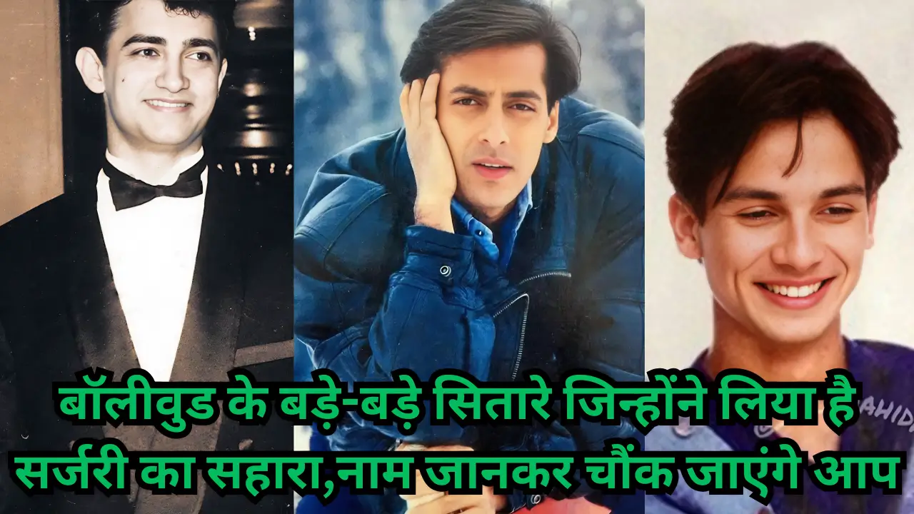 Actors who resorted to surgery to look younger