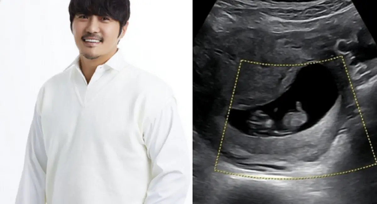 Korean Singer KCM: तीसरी बार पिता बनने की खुशी की ज़ाहिर,फैंस के साथ बाटी खुशियाँ